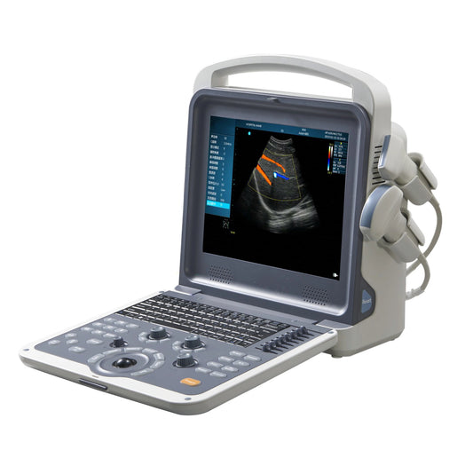 12” Colour Doppler Ultrasound Diagnostic System Human